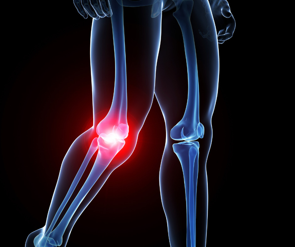 kneecap in motion